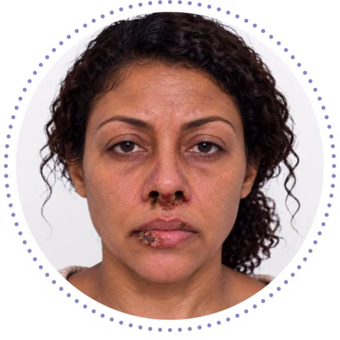 Photo representing patient profile "Erica," a 42-year-old female (stock imagery; not an actual patient)