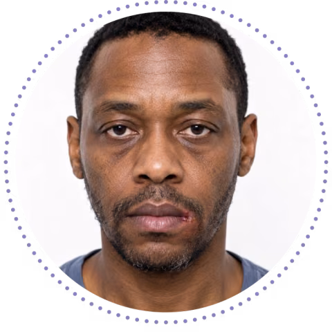 Photo representing patient profile "Mikel," a 47-year-old male (stock imagery; not an actual patient)